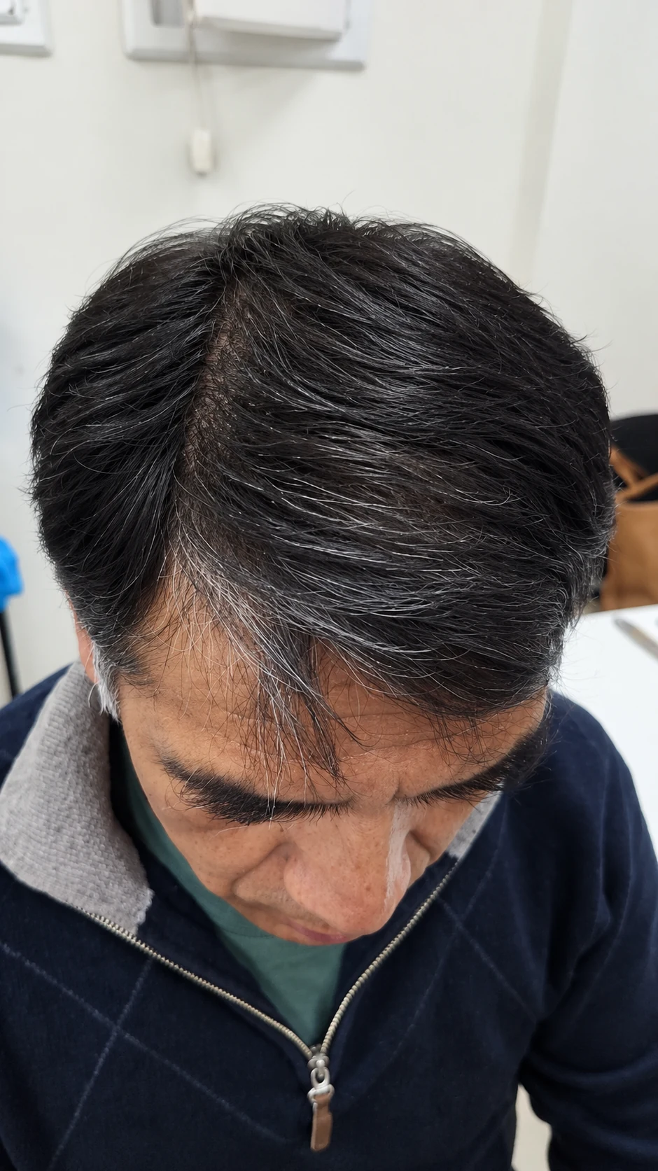 Fotografía despues de la comparación capilar 2
